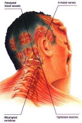Natural Ways To Fight Migraine And Headache